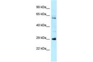 Image no. 1 for anti-Hydroxysteroid (17-Beta) Dehydrogenase 8 (HSD17B8) (AA 51-100) antibody (ABIN6747948)