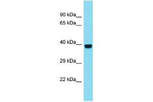 Western Blotting (WB) image for anti-N-Acetylated alpha-Linked Acidic Dipeptidase-Like 2 (NAALADL2) (C-Term) antibody (ABIN2790659)