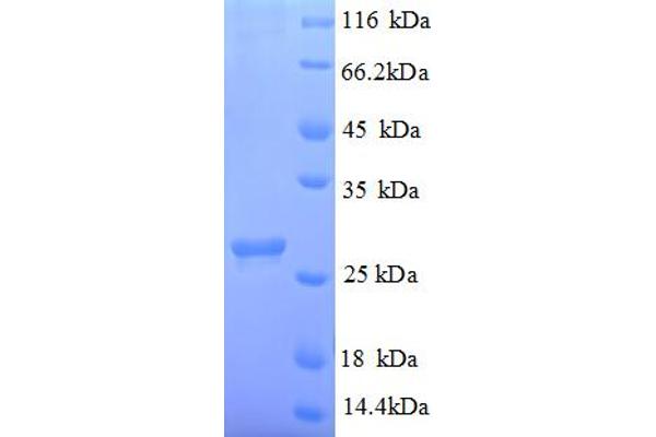 Abscisic Acid Receptor PYL1 (PYL1) (AA 8-221), (partial) protein (His tag)