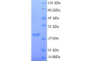 SDS-PAGE (SDS) image for Abscisic Acid Receptor PYL1 (PYL1) (AA 8-221), (partial) protein (His tag) (ABIN4975128)