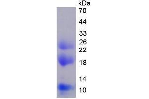 Image no. 2 for Matrix Metallopeptidase 9 (Gelatinase B, 92kDa Gelatinase, 92kDa Type IV Collagenase) (MMP9) (AA 226-391) protein (His tag) (ABIN1980763) (MMP 9 Protein (AA 226-391) (His tag))