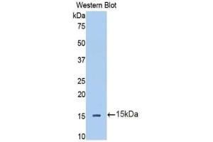 Western blot analysis of the recombinant protein. (IL13RA2 antibody  (AA 238-334))