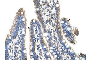 SLC25A39 antibody was used for immunohistochemistry at a concentration of 4-8 ug/ml to stain Epithelial cells of intestinal villus (arrows) in Human Intestine.
