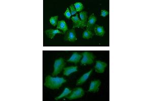 ICC/IF analysis of AHA1 in Hep3B cells line, stained with DAPI (Blue) for nucleus staining and monoclonal anti-human AHA1 antibody (1:100) with goat anti-mouse IgG-Alexa fluor 488 conjugate (Green). (AHSA1 antibody  (AA 19-337))