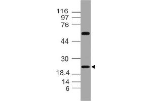 Image no. 1 for anti-Fibroblast Growth Factor 20 (FGF20) antibody (ABIN5027715) (FGF20 antibody)