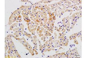 Formalin-fixed and paraffin embedded rat heart tissue labeled with Anti-STAT2 Polyclonal Antibody, Unconjugated  at 1:200 followed by conjugation to the secondary antibody and DAB staining (STAT2 antibody  (AA 151-250))