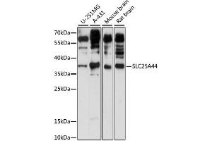 Western blot analysis of extracts of various cell lines, using SLC25A44 antibody (ABIN6293926) at 1:1000 dilution. (SLC25A44 antibody)