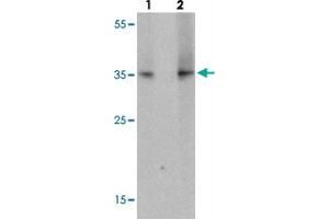 Western blot analysis of TLX1 in mouse spleen tissue with TLX1 polyclonal antibody  at (lane 1) 1 ug/mL and (lane 2) 2 ug/mL. (TLX1 antibody  (N-Term))