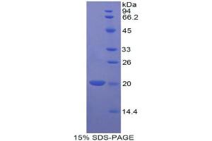 SDS-PAGE analysis of Dog Bcl2L2 Protein. (BCL2L2 Protein)