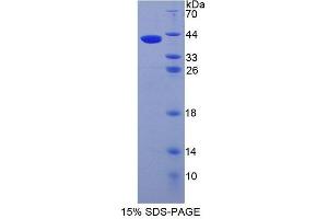 SDS-PAGE analysis of Human AMIGO1 Protein. (AMIGO1 Protein)