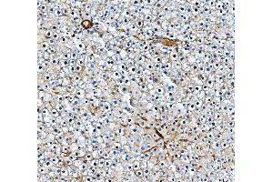 IHC analysis of Pecam1 using anti-Pecam1 antibody (ABIN7601672).