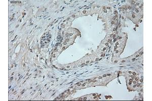 Immunohistochemical staining of paraffin-embedded lung tissue using anti-NEUROG1mouse monoclonal antibody. (Neurogenin 1 antibody)