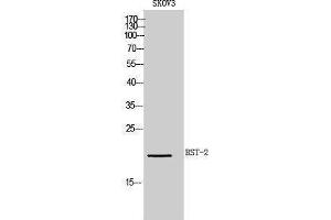 Western Blotting (WB) image for anti-Bone Marrow Stromal Cell Antigen 2 (BST2) (Internal Region) antibody (ABIN3181452)