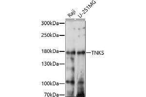 Western blot analysis of extracts of various cell lines, using TNKS antibody (ABIN7270725) at 1:1000 dilution. (TNKS antibody  (AA 1050-1150))