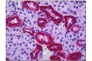 Human Renal Tubules: Formalin-Fixed, Paraffin-Embedded (FFPE) (TSPO antibody  (C-Term))