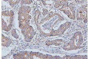 IHC analysis of PDCD6IP using anti-PDCD6IP antibody (ABIN7600490).