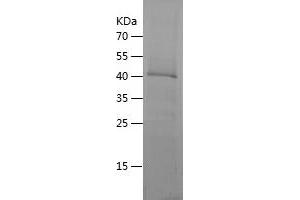 EIF2S3 Protein (AA 10-204) (His-IF2DI Tag)