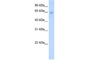 Western Blotting (WB) image for anti-Cytochrome P450, Family 2, Subfamily E, Polypeptide 1 (CYP2E1) (C-Term) antibody (ABIN2776801)