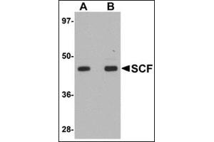 Western blot analysis of SCF in rat brain tissue lysate with this product at (A) 1 and (B) 2 μg/ml. (KIT Ligand antibody  (Center))