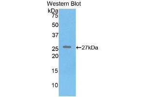 Western blot analysis of recombinant Human ELN. (Elastin antibody  (AA 392-645))