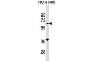 Western Blotting (WB) image for anti-PET112 Homolog (PET112) antibody (ABIN2999660)