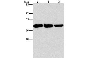 Western Blot analysis of Human normal liver tissue, Mouse brain and heart tissue using GOT1 Polyclonal Antibody at dilution of 1:1600 (GOT1 antibody)
