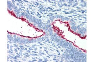 Anti-MUC16 / CA-125 antibody IHC of human uterus. (MUC16 antibody)
