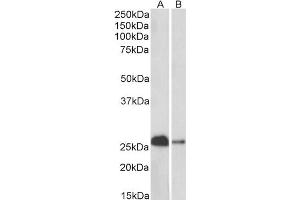Western Blotting (WB) image for anti-Calbindin (CALB1) (Internal Region) antibody (ABIN5539806)
