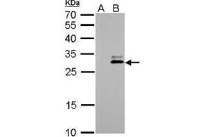 WB Image KLK7 antibody detects KLK7 protein by Western blot analysis. (Kallikrein 7 antibody)