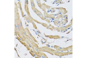 Immunohistochemistry of paraffin-embedded mouse heart using SFRP4 antibody at dilution of 1:100 (40x lens). (SFRP4 antibody)