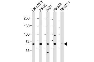 All lanes : Anti-MeCP2 Antibody at 1:2000 dilution Lane 1: SH-SY5Y whole cell lysates Lane 2: Jurkat whole cell lysates Lane 3: A431 whole cell lysates Lane 4: HepG2 whole cell lysates Lane 5: NIH/3T3 whole cell lysates Lysates/proteins at 20 μg per lane. (MECP2 antibody  (AA 400-428))
