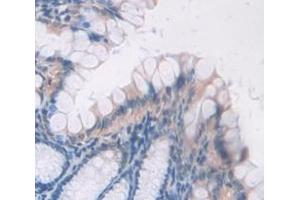 IHC-P analysis of Mouse Tissue, with DAB staining. (BMP2 antibody  (AA 281-394))
