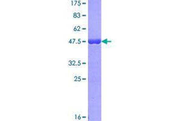 C17orf49 Protein (AA 1-172) (GST tag)