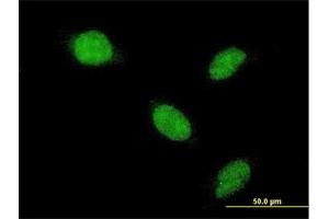 Immunofluorescence of monoclonal antibody to AHR on HeLa cell. (Aryl Hydrocarbon Receptor antibody  (AA 721-820))