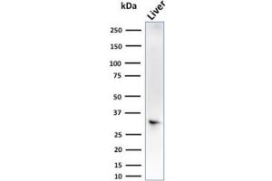 Western Blot Analysis of liver tissue lysate using SULT1E1 Mouse Monoclonal Antibody (CPTC-SULT1E1-1). (SULT1E1 antibody)