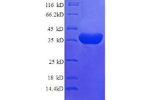 SDS-PAGE (SDS) image for Islet Cell Autoantigen 1, 69kDa (ICA1) (AA 1-268), (partial) protein (His tag) (ABIN4974705)