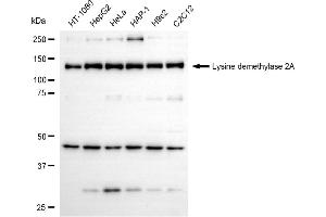 Western blotting analysis using lysine demethylase 2A antibody (ABIN7799299). (Recombinant KDM2A antibody)