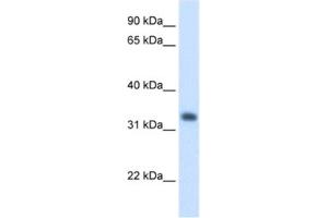 Western Blotting (WB) image for anti-3-Hydroxymethyl-3-Methylglutaryl-CoA Lyase (HMGCL) antibody (ABIN2462454)