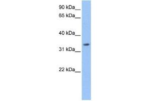 Beta Lactamase antibody used at 1 ug/ml to detect target protein. (LACTB antibody  (Middle Region))