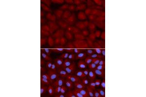 Immunofluorescence analysis of U2OS cells using BIN1 antibody. (BIN1 antibody)