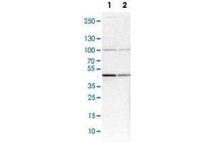 Western Blot analysis of Lane 1: NIH-3T3 cell lysate (mouse embryonic fibroblast cells) and Lane 2: NBT-II cell lysate (Wistar rat bladder tumor cells) with HSP90B1 polyclonal antibody . (GRP94 antibody)
