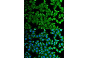 Immunofluorescence (IF) image for anti-Kallikrein B, Plasma (Fletcher Factor) 1 (KLKB1) antibody (ABIN1876506) (KLKB1 antibody)