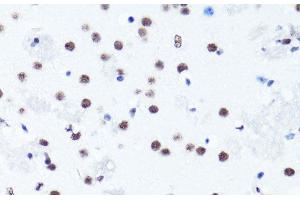 Immunohistochemistry of paraffin-embedded Mouse brain using Symmetric DiMethyl-Histone H3-R2 Polyclonal Antibody at dilution of 1:100 (40x lens). (Histone 3 antibody  (H3R2me2s))