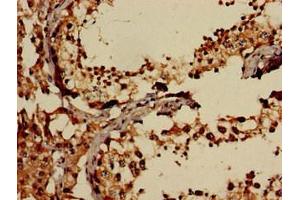 Immunohistochemistry (IHC) image for anti-Eukaryotic Translation Initiation Factor 2-alpha Kinase 1 (EIF2AK1) (AA 1-86) antibody (ABIN7152137)