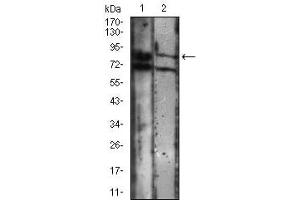 Western blot analysis using CDH16 mouse mAb against A431 (1), Jurkat (2) cell lysate. (Cadherin-16 antibody)