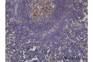 Immunoperoxidase of monoclonal antibody to KIAA0101 on formalin-fixed paraffin-embedded human lymph node tissue. (KIAA0101 antibody  (AA 1-111))