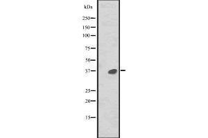 Western blot analysis of MAPRE2 expression in CEM cell line lysate ,The lane on the left is treated with the antigen-specific peptide.