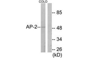 Western blot analysis of extracts from COLO205 cells, using AP-2 Antibody. (TFAP2A antibody  (AA 388-437))