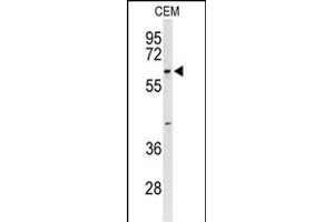 Western blot analysis of TCHP Antibody (Center) (ABIN653303 and ABIN2842803) in CEM cell line lysates (35 μg/lane). (TCHP antibody  (AA 291-320))