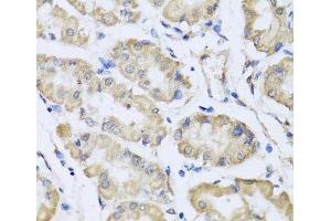 Immunohistochemistry of paraffin-embedded Human stomach using RCN2 Polyclonal Antibody at dilution of 1:100 (40x lens). (RCN2 antibody)